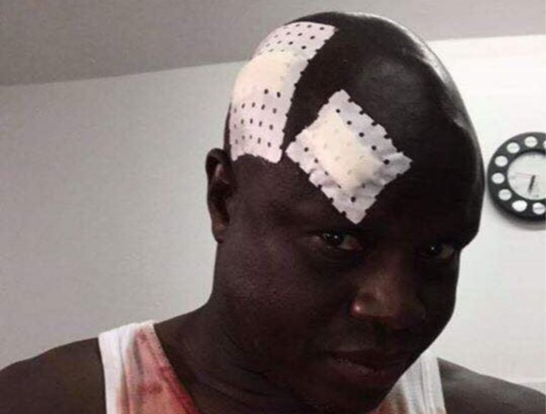 Photo : Amara Traoré agressé au Stade Caroline Faye de Mbour Photo : Amara Traoré agressé au Stade Caroline Faye de Mbour