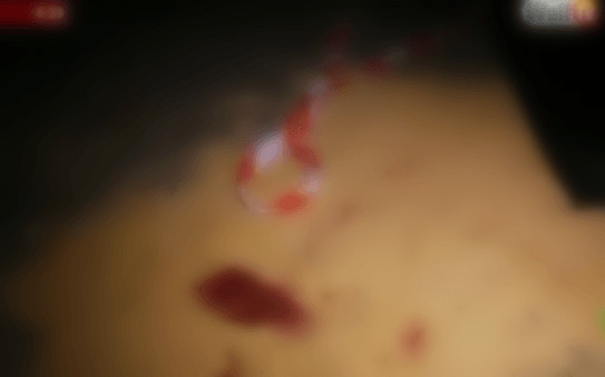 Bagarre à l’arme blanche entre jeunes à Yeumbeul : Aly Thioub poignardé au cœur Bagarre à l’arme blanche entre jeunes à Yeumbeul : Aly Thioub poignardé au cœur