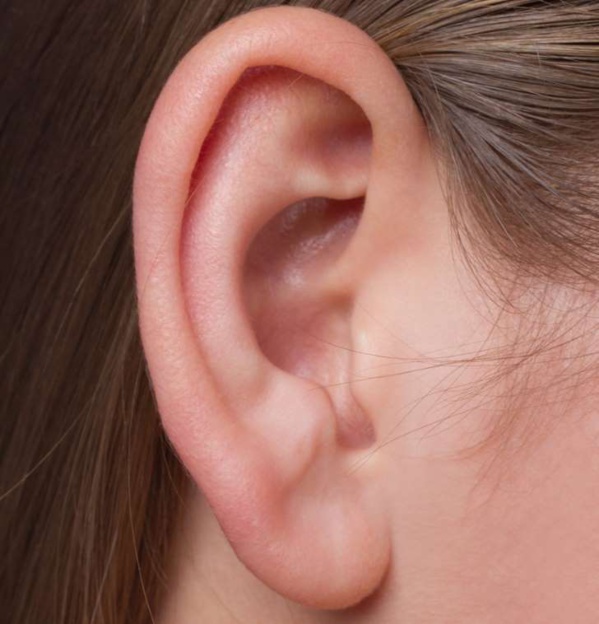 AVC : cette marque sur votre lobe d’oreille indique que vous êtes à risque