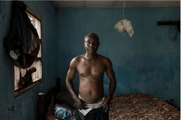 Des victimes du régime de Yaya Jammeh (Photo) Des victimes du régime de Yaya Jammeh (Photo)