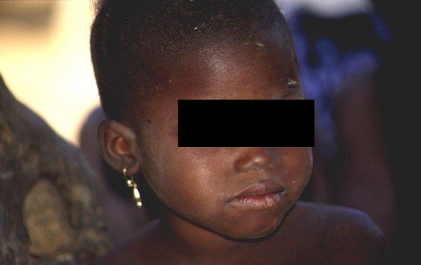 Un cultivateur de 40 ans sodomise des fillettes (Kolda) Un cultivateur de 40 ans sodomise des fillettes (Kolda)