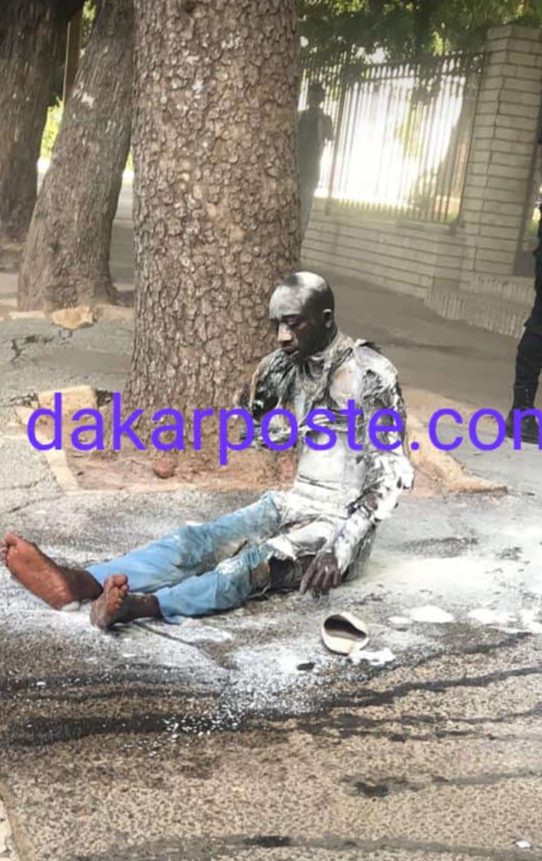 Urgent- Un jeune s'immole devant le Palais PrÃ©sidentiel