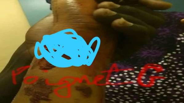 Une Femme Assène Plusieurs Coups De Machette À Sa Co-Épouse Une Femme Assène Plusieurs Coups De Machette À Sa Co-Épouse