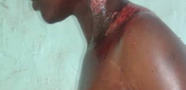 Kaffrine : Une femme ébouillante sa co-épouse [Photos]