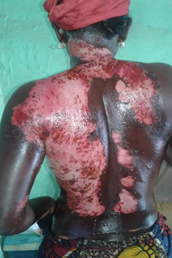 Kaffrine : Une femme ébouillante sa co-épouse [Photos]