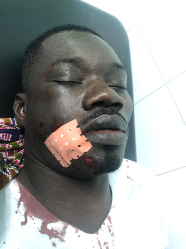 Guin Thieuss échappe de justesse à une tentative de meurtre par aggression Guin Thieuss échappe de justesse à une tentative de meurtre par aggression