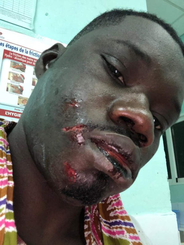 Guin Thieuss échappe de justesse à une tentative de meurtre par aggression Guin Thieuss échappe de justesse à une tentative de meurtre par aggression