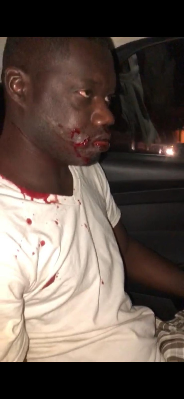 Guin Thieuss échappe de justesse à une tentative de meurtre par aggression Guin Thieuss échappe de justesse à une tentative de meurtre par aggression