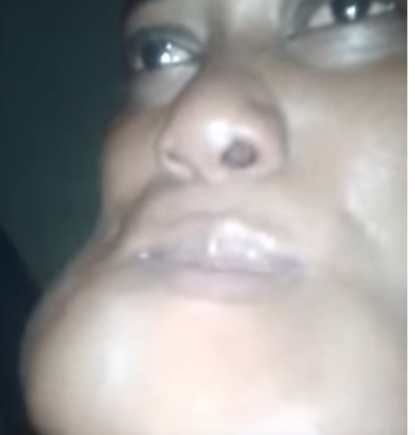 Cri de cœur : Terrassée par une tumeur, cette jeune fille demande de l’aide… (vidéo) Cri de cœur : Terrassée par une tumeur, cette jeune fille demande de l’aide… (vidéo)