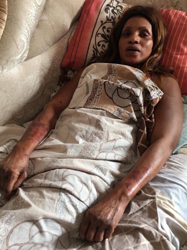 Cite Mixta : Une femme suicidaire qui tente de sauter du haut d’un immeuble se fait violenter par des ASP et menace de porter plainte