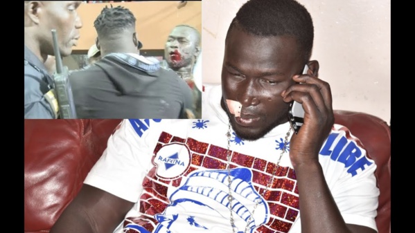 Alioune Sèye 2 réagit à sa blessure