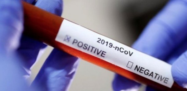 Covid-19 : 7 cas positifs enregistrés à Vélingara