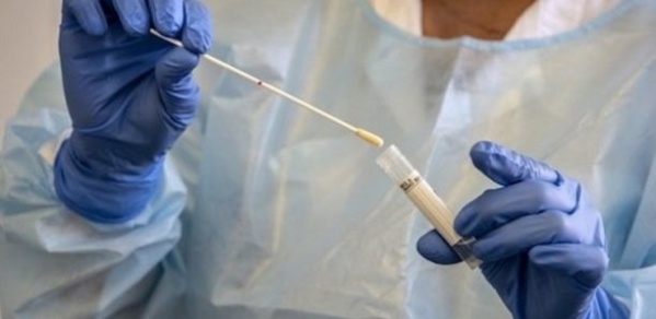 Covid-19 : Un kit de test rapide attendu sur le marché en juin