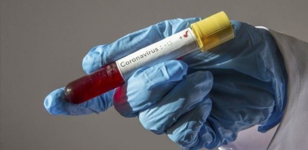 Covid-19 au Mali : 25 décès pour 482 cas positifs Covid-19 au Mali : 25 décès pour 482 cas positifs