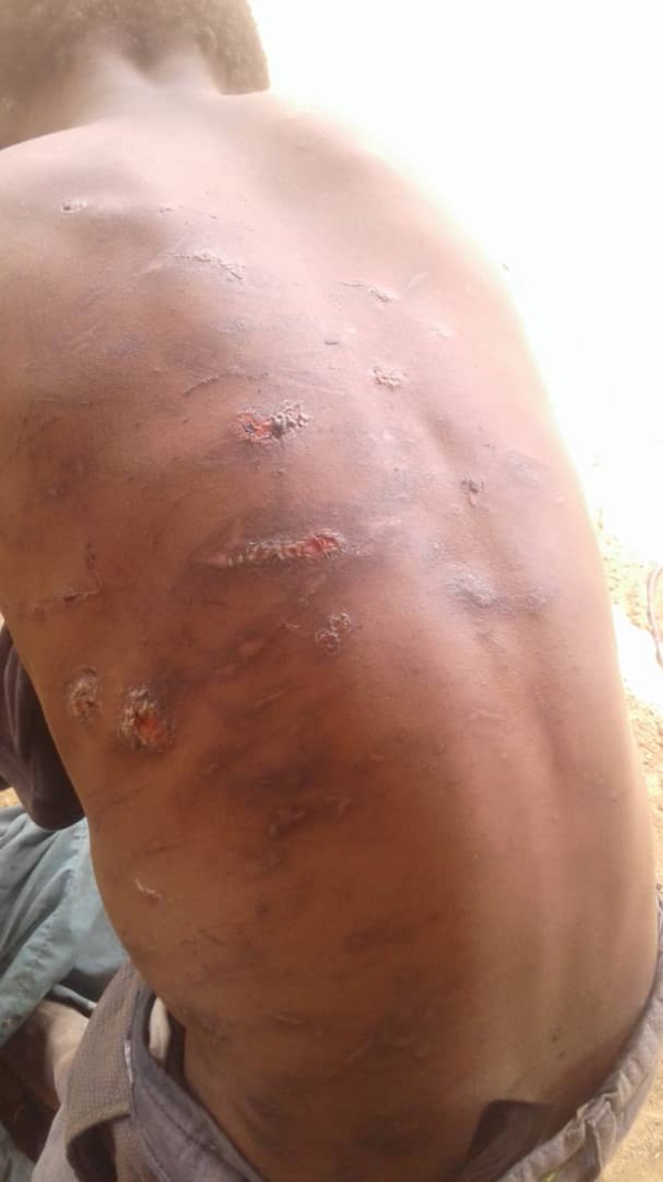 Thiès : Trois talibés gambiens sauvagement lynchés par leur marabout. Thiès : Trois talibés gambiens sauvagement lynchés par leur marabout.