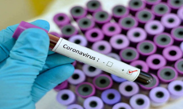 CORONAVIRUS : 2 SÉNÉGALAIS TESTÉS POSITIFS EN GAMBIE CORONAVIRUS : 2 SÉNÉGALAIS TESTÉS POSITIFS EN GAMBIE
