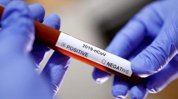 CORONAVIRUS : GOUDIRY PASSE DE 63 À 0 CAS