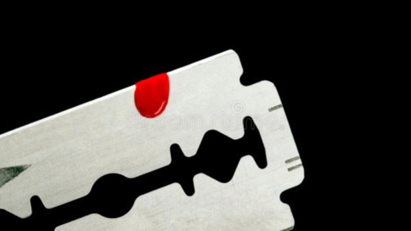 Croyant que sa sœur sortait avec l’homme qu’elle aime, Rougui Diallo lui lacère le visage et la jambe avec une lame Croyant que sa sœur sortait avec l’homme qu’elle aime, Rougui Diallo lui lacère le visage et la jambe avec une lame