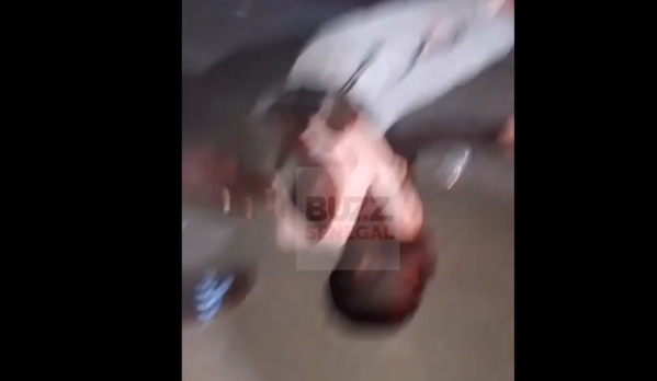 Kaolack : Le jeune homme de 25 ans percuté hier par un véhicule de la police, se porte bien.