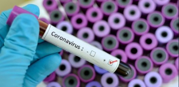 Covid-19: Deux joueurs marocains testés positifs Covid-19: Deux joueurs marocains testés positifs