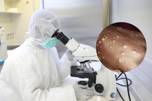 Maladie "Mystérieuse": Ce qu'indiquent les premiers résultats des tests! Maladie "Mystérieuse": Ce qu'indiquent les premiers résultats des tests!