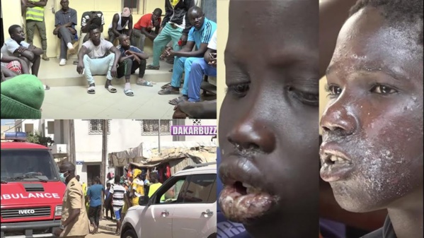 6 autres localités et prés de 700 personnes touchées par la mystérieuse maladie 6 autres localités et prés de 700 personnes touchées par la mystérieuse maladie