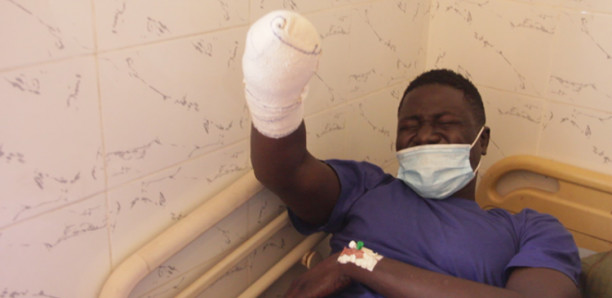 Amputé du bras lors des émeutes : Pourquoi Cheikh Diouf a été arrêté Amputé du bras lors des émeutes : Pourquoi Cheikh Diouf a été arrêté
