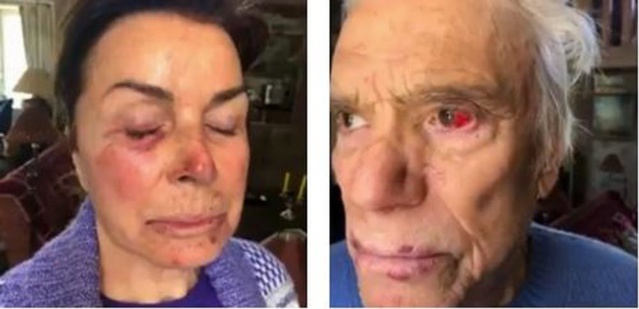 CE QUE L'ON SAIT DU VIOLENT "HOME JACKING" DE BERNARD TAPIE ET SON ÉPOUSE CE QUE L'ON SAIT DU VIOLENT "HOME JACKING" DE BERNARD TAPIE ET SON ÉPOUSE