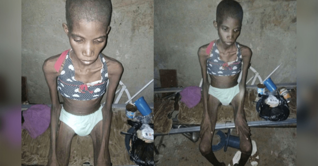 Nigéria : Sa tante l'a enfermée dans une cage et privée de nourriture pendant 8 mois Nigéria : Sa tante l'a enfermée dans une cage et privée de nourriture pendant 8 mois