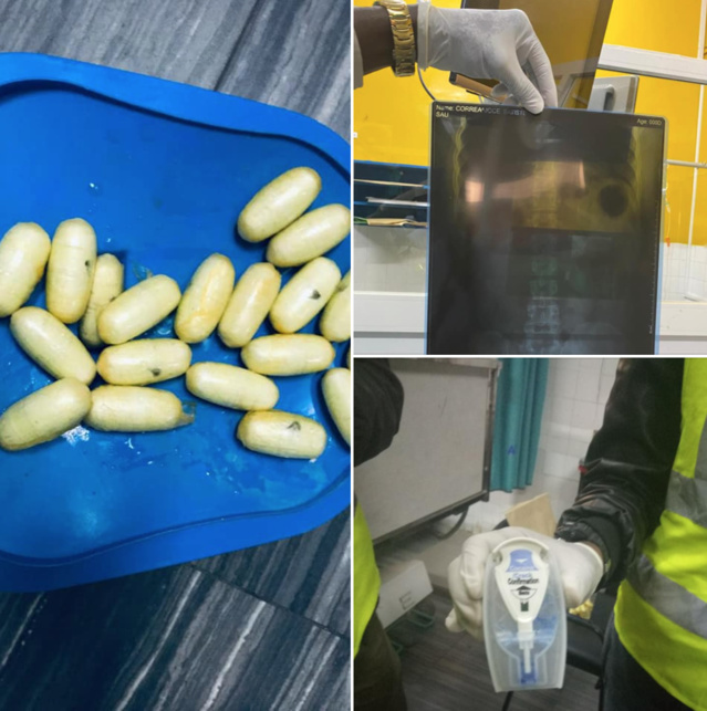 AIBD : De la cocaïne saisie sur une «mule » AIBD : De la cocaïne saisie sur une «mule »