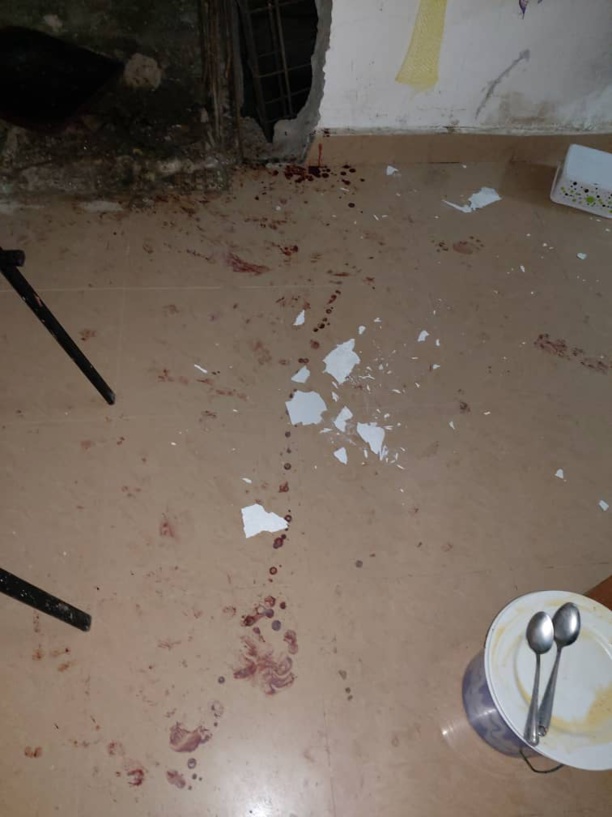 Barthelemy Dias sème la violence à Sacré cœur : 3 blessés graves, des coups de feu tirés Barthelemy Dias sème la violence à Sacré cœur : 3 blessés graves, des coups de feu tirés