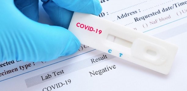 Faux tests de Covid-19: Le faux médecin a empoché plus de 30 millions F CFA