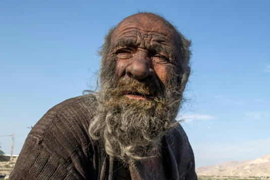 Iran: l'homme "le plus sale du monde" est mort à l'âge de 94 ans Iran: l'homme "le plus sale du monde" est mort à l'âge de 94 ans