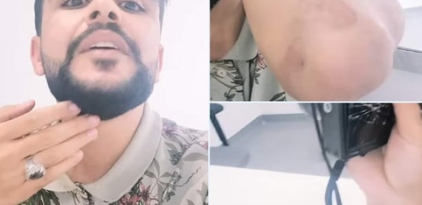"J'ai fait tout ça pour l'Algérie" : le Youtubeur frappé par Eto’o brise le silence "J'ai fait tout ça pour l'Algérie" : le Youtubeur frappé par Eto’o brise le silence