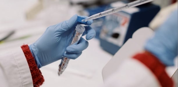 [Focus] Fièvre hémorragique Crimée Congo : Radioscopie d’une pathologie contagieuse et mortelle