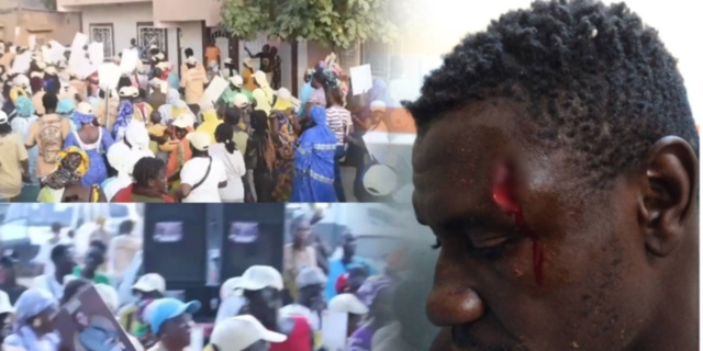 Mbour : 4 blessés enregistrés durant des échauffourées entre militants du parti au pouvoir Mbour : 4 blessés enregistrés durant des échauffourées entre militants du parti au pouvoir
