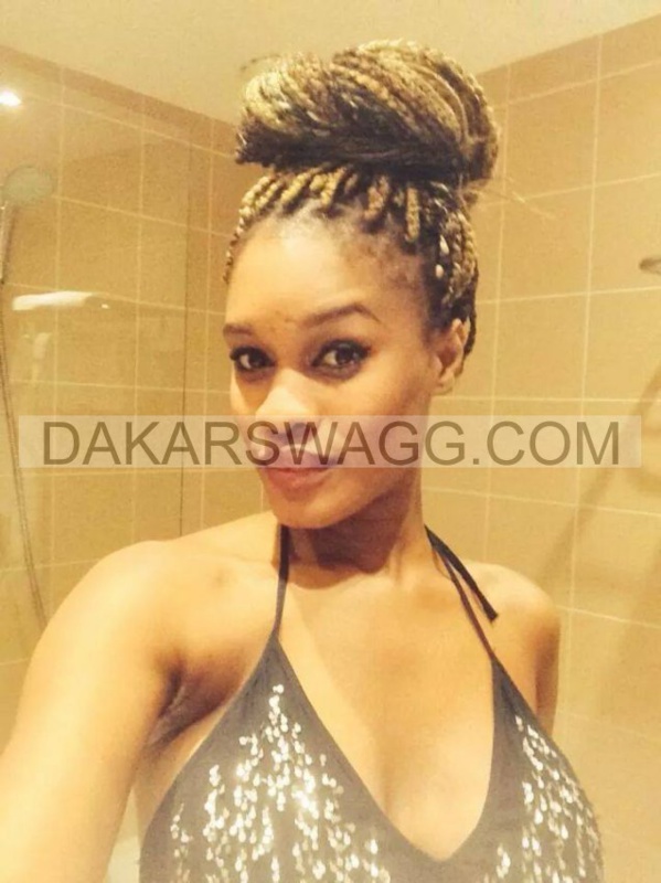 Chirurgie esthétique totale pour Ndèye Ndack Chirurgie esthétique totale pour Ndèye Ndack