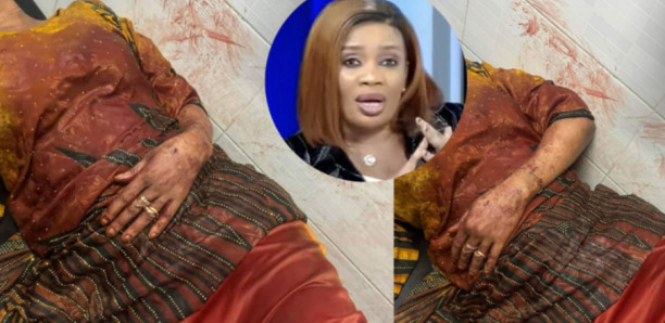 Maïmouna Ndour Faye agressée et poignardée Maïmouna Ndour Faye agressée et poignardée
