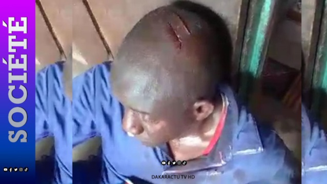 Médina Gounass (Kolda) : Violents incidents entre communautés en ce jour de Tabaski... Médina Gounass (Kolda) : Violents incidents entre communautés en ce jour de Tabaski...