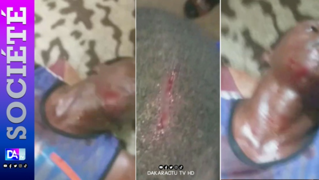 Mutinerie au Camp pénal de Liberté 6 : Des détenus blessés par balles à blanc... Mutinerie au Camp pénal de Liberté 6 : Des détenus blessés par balles à blanc...