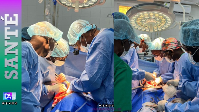 Hôpital militaire de Ouakam (HMO) réussit une 4e transplantation Rénale Hôpital militaire de Ouakam (HMO) réussit une 4e transplantation Rénale