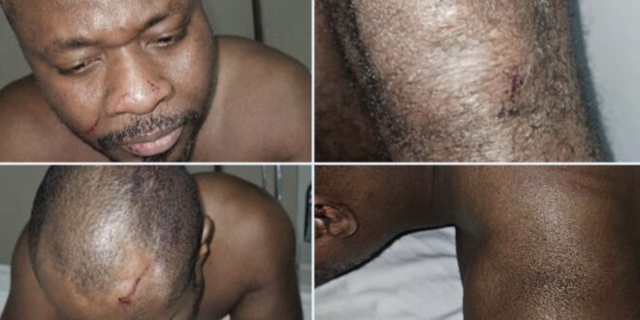 Guy Marius Sagna raconte son agression au Togo Guy Marius Sagna raconte son agression au Togo