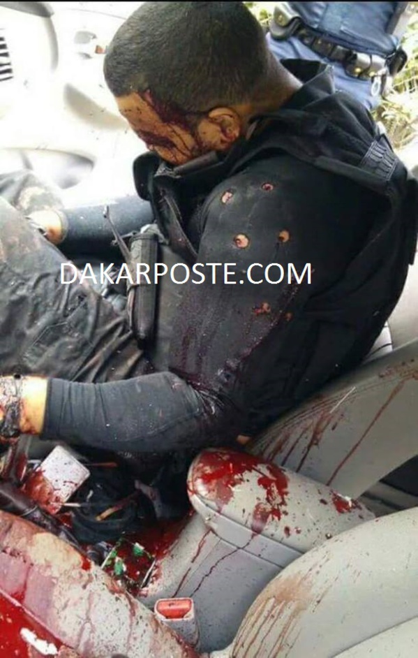 Exclusif dakarposte! L'un des terroristes, criblé de balles par la police Francaise, suite au carnage du vendredi 13 novembre 2015. Exclusif dakarposte! L'un des terroristes, criblé de balles par la police Francaise, suite au carnage du vendredi 13 novembre 2015.