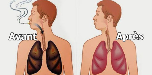 Le saviez-vous? Ces  aliments qui nettoient vos poumons des goudrons et de la nicotine