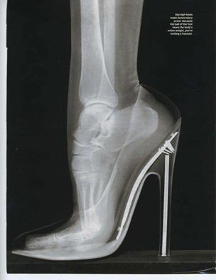 Un pied dans une chaussure à talon….Le tout passé au rayon X .