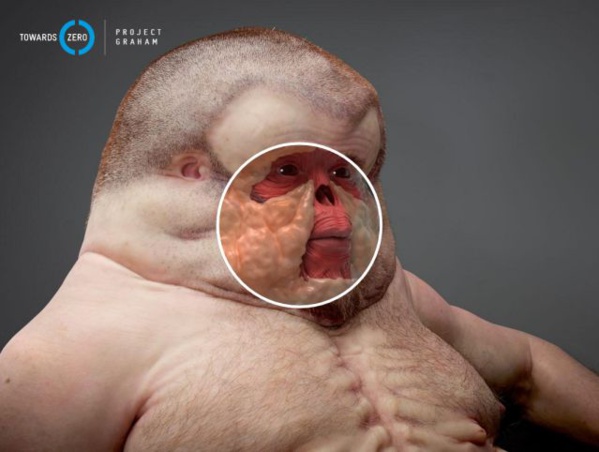 Voici Graham, l'humain (immonde) conçu pour survivre à un accident de la route Voici Graham, l'humain (immonde) conçu pour survivre à un accident de la route