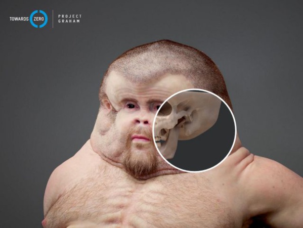 Voici Graham, l'humain (immonde) conçu pour survivre à un accident de la route