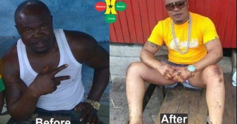 Le boxeur ghanéen Bukom Banku : « Déçu d’être noir, j’ai enfin réussi à devenir blanc »