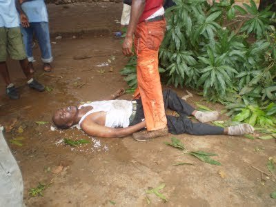 Thiès : un jeune perd son œil après un match de football Thiès : un jeune perd son œil après un match de football