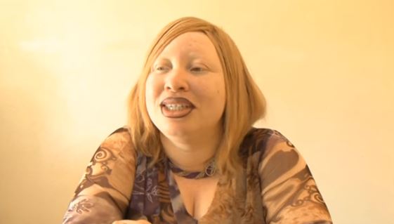 Enquête sur la vie des Albinos en Afrique Enquête sur la vie des Albinos en Afrique